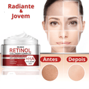 Creme Removedor - Retinol Cream™ [Compre 1 & Leve 2]