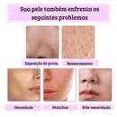 Creme para pele - Hunmui™ [Removedor de Melasma, Clareador]
