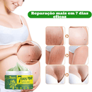 Striskin - Creme Antiestrias e Varizes Brancas E Vermelhas™