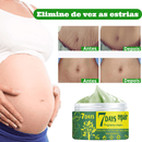 Striskin - Creme Antiestrias e Varizes Brancas E Vermelhas™