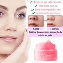 Creme para pele - Hunmui™ [Removedor de Melasma, Clareador]